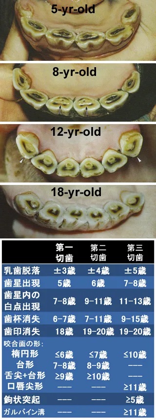 20220731_Blog_HC027_DentalAging_Pict1.jpg
